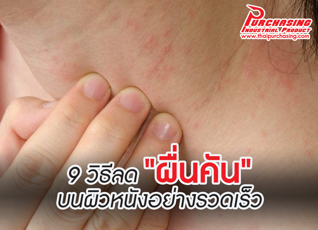 9 วิธีลด 