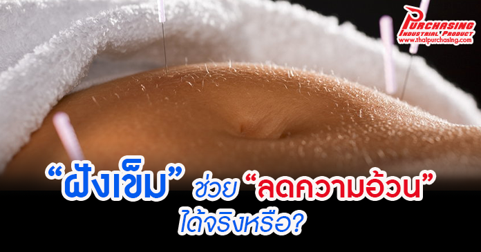 “ฝังเข็ม” ช่วย “ลดความอ้วน” ได้จริงหรือ?